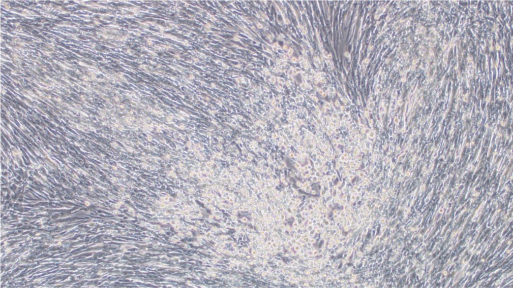 BHK-21 cells were transduced with VACV.